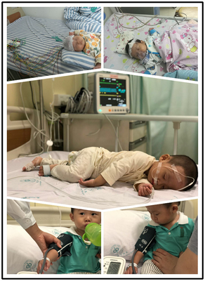 Elektroda Hisap Elektroda EKG Serbaguna 40421A Untuk Banana 4.0 Din 3.0 Snap